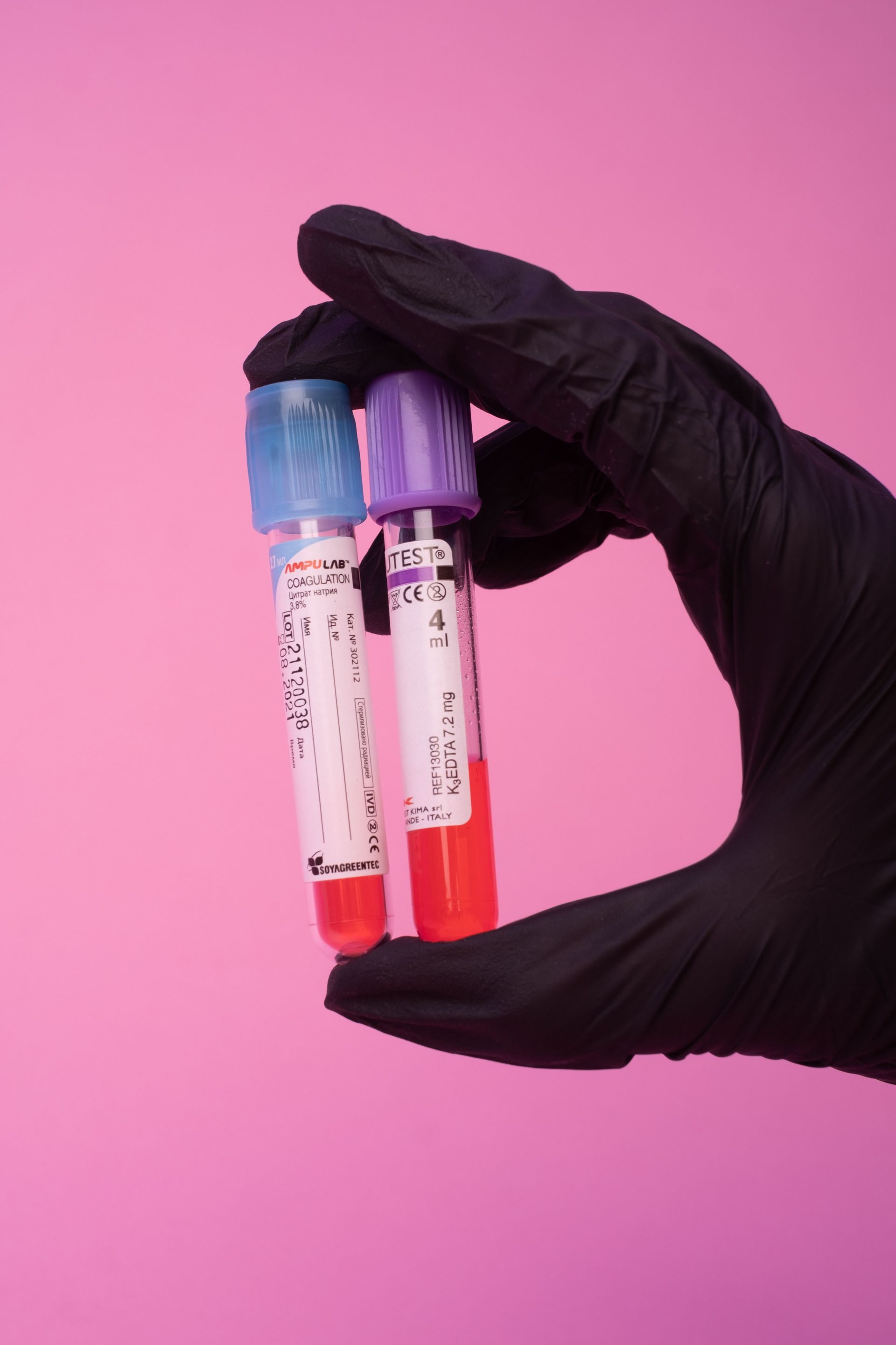 Crop anonymous medical specialist in black latex gloves demonstrating test tubes with blood samples against pink background