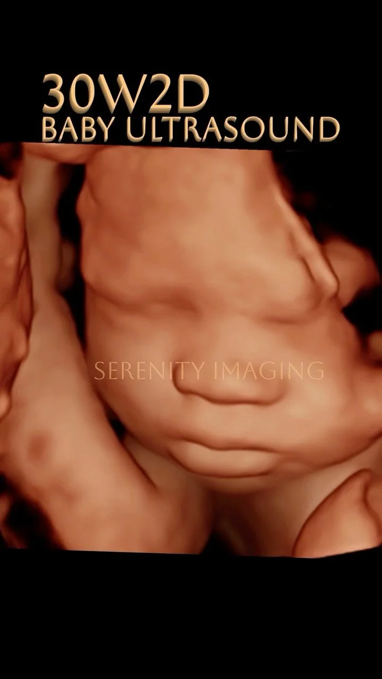 sld1 ultrasound r1