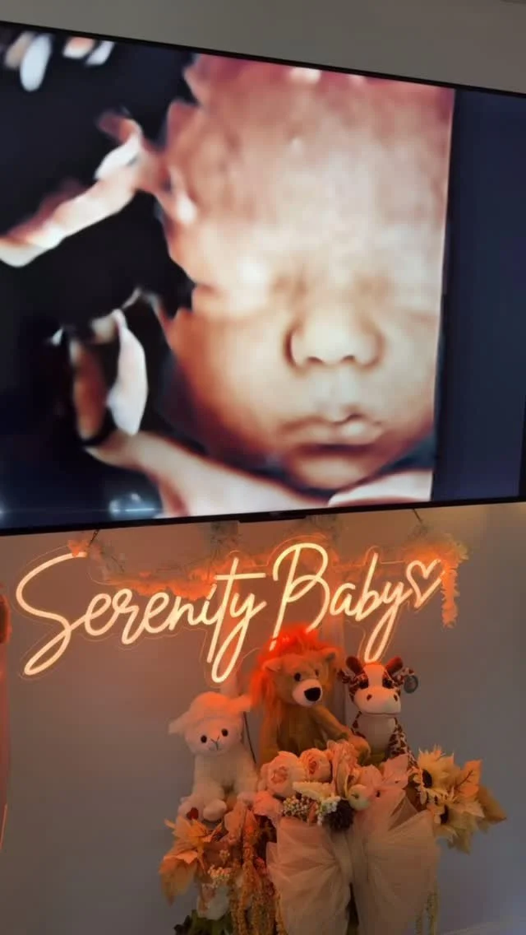 sld2 ultrasound r1