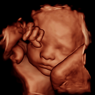 4D ULTRASOUND